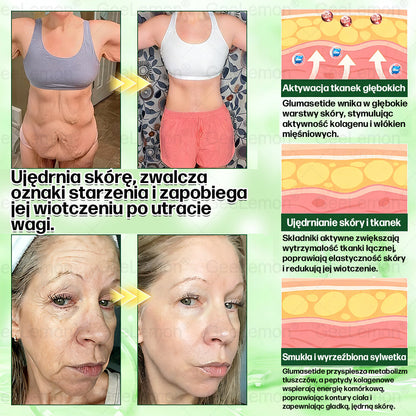 ✨Oficjalny Sklep | 👩‍⚕️🎁 𝐆𝐞𝑒𝐿𝑒𝐦𝐨𝐧® 𝐆𝐥𝐮𝐦ase𝐭𝐢𝐝𝐞 𝟖 𝐰 𝟏 Smukły i Zdrowy Nano Plaster z Mikronakłuciami 🇵🇱(Tylko raz dziennie, widoczne zmiany już w 7 dni)✅ Na otyłość, 🅛🅞🅞🅢🅔 🅢🅚🅘🅝 wiotką skórę, cukrzycę, bezdech senny, problemy ze stawami i wiele więcej