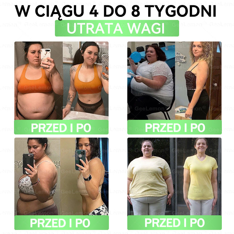 ✨Oficjalny Sklep | 👩‍⚕️🎁 𝐆𝐞𝑒𝐿𝑒𝐦𝐨𝐧® 𝐆𝐥𝐮𝐦ase𝐭𝐢𝐝𝐞 𝟖 𝐰 𝟏 Smukły i Zdrowy Nano Plaster z Mikronakłuciami 🇵🇱(Tylko raz dziennie, widoczne zmiany już w 7 dni)✅ Na otyłość, 🅛🅞🅞🅢🅔 🅢🅚🅘🅝 wiotką skórę, cukrzycę, bezdech senny, problemy ze stawami i wiele więcej