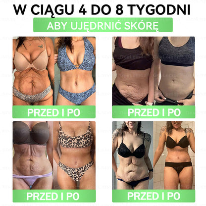 ✨Oficjalny Sklep | 👩‍⚕️🎁 𝐆𝐞𝑒𝐿𝑒𝐦𝐨𝐧® 𝐆𝐥𝐮𝐦ase𝐭𝐢𝐝𝐞 𝟖 𝐰 𝟏 Smukły i Zdrowy Nano Plaster z Mikronakłuciami 🇵🇱(Tylko raz dziennie, widoczne zmiany już w 7 dni)✅ Na otyłość, 🅛🅞🅞🅢🅔 🅢🅚🅘🅝 wiotką skórę, cukrzycę, bezdech senny, problemy ze stawami i wiele więcej