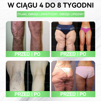 ✨Oficjalny Sklep | 👩‍⚕️🎁 𝐆𝐞𝑒𝐿𝑒𝐦𝐨𝐧® 𝐆𝐥𝐮𝐦ase𝐭𝐢𝐝𝐞 𝟖 𝐰 𝟏 Smukły i Zdrowy Nano Plaster z Mikronakłuciami 🇵🇱(Tylko raz dziennie, widoczne zmiany już w 7 dni)✅ Na otyłość, 🅛🅞🅞🅢🅔 🅢🅚🅘🅝 wiotką skórę, cukrzycę, bezdech senny, problemy ze stawami i wiele więcej